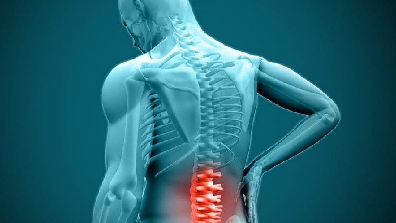 تزریق ژل برای دیسک کمر؛ روشی نوین بدون جراحی که فقط با تشخیص متخصص قابل اجراست